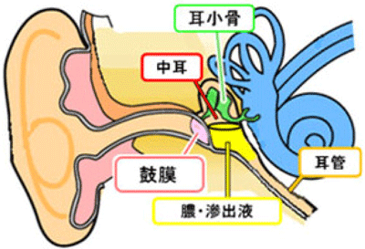 耳鼻咽喉科　はるクリニック　滲出性中耳炎